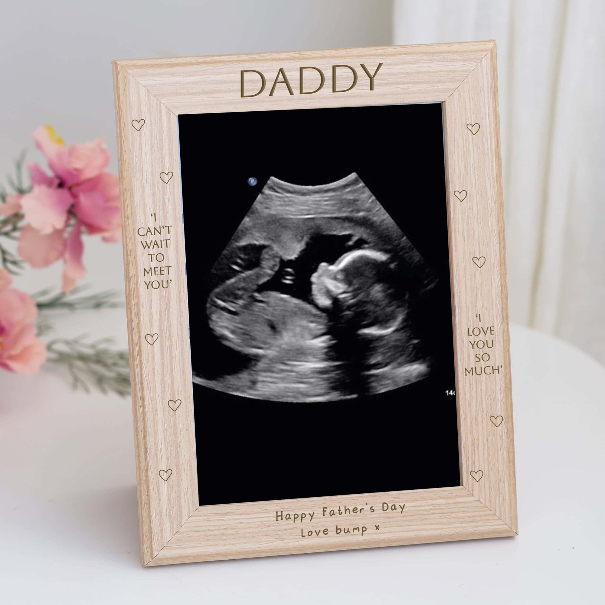 Personalised Wooden Scan Photo 'Can't Wait To Meet You' Frame