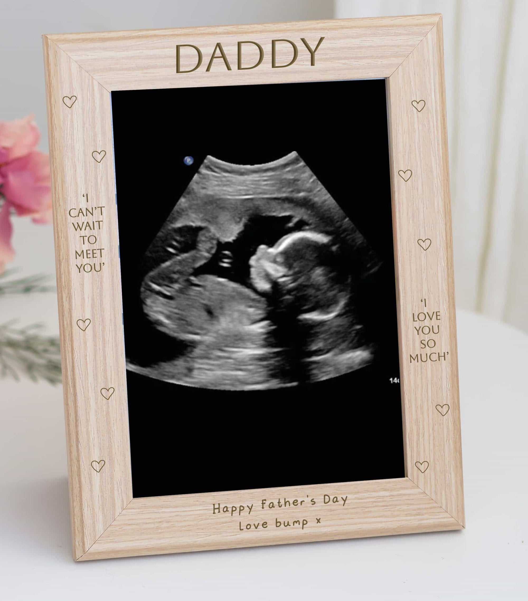 Personalised Wooden Scan Photo 'Can't Wait To Meet You' Frame